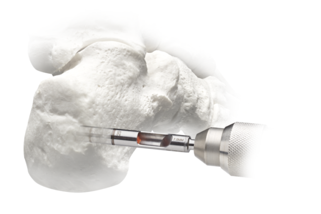 Dental drill extracting a sample from a molar tooth model.