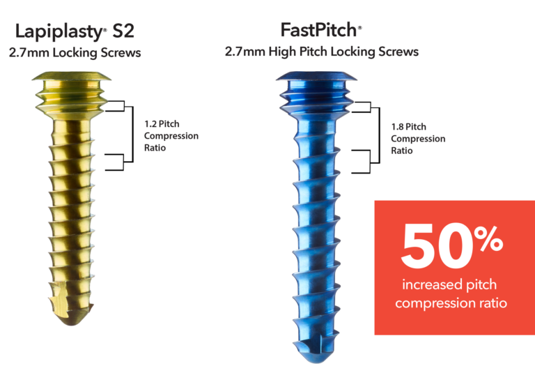 Comparison of two locking screws with different pitch compression ratios, one gold and one blue, and a 50% increase note.