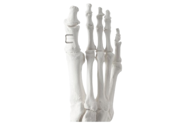 human foot skeleton model on white background displaying bones and joints clearly