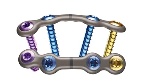 Colorful spinal fixation device with multi-colored screws used in medical procedures for bone stabilization.