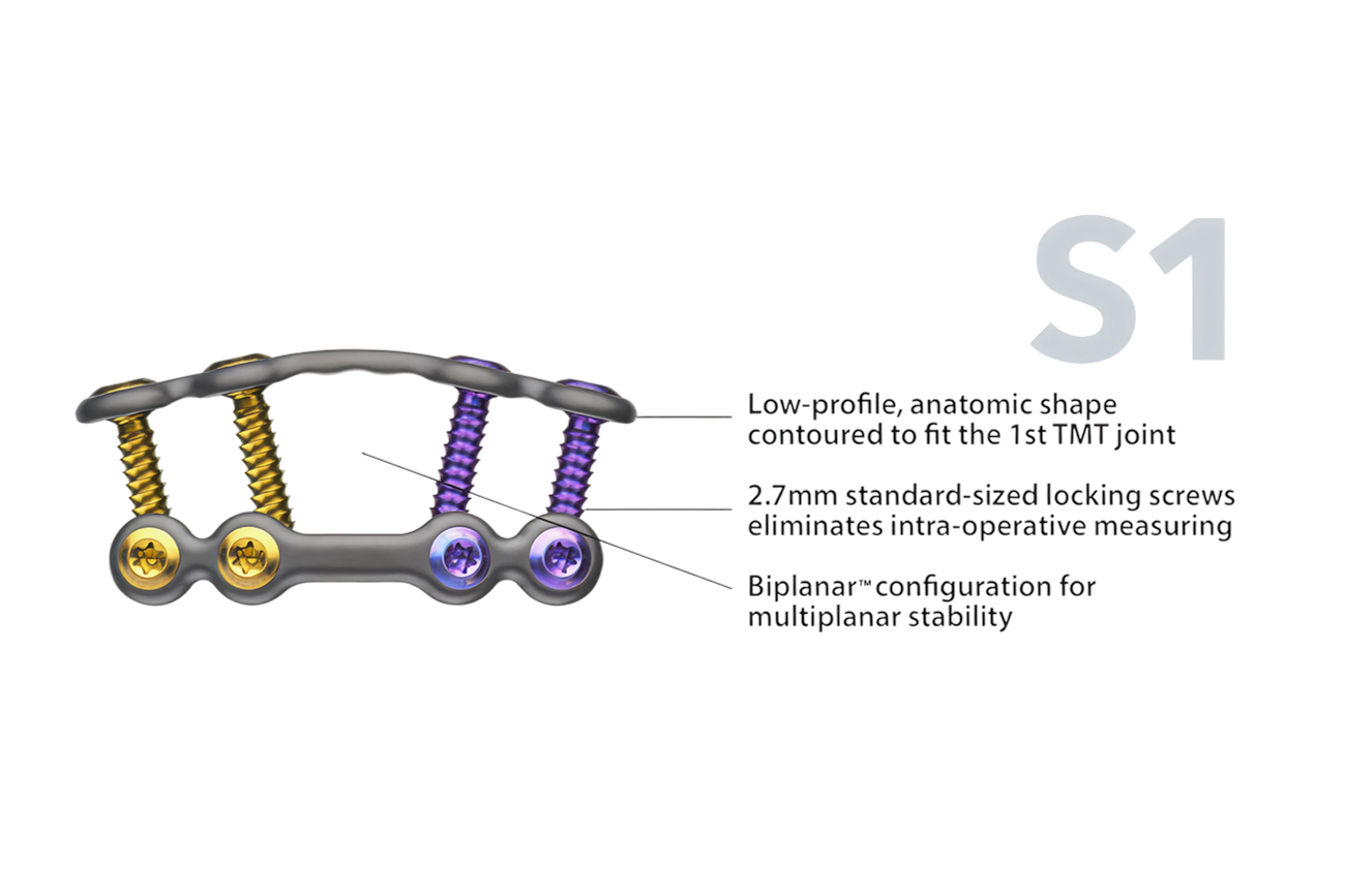 Orthopedic implant with low-profile, anatomic shape and three standard-sized locking screws for multiplanar stability.