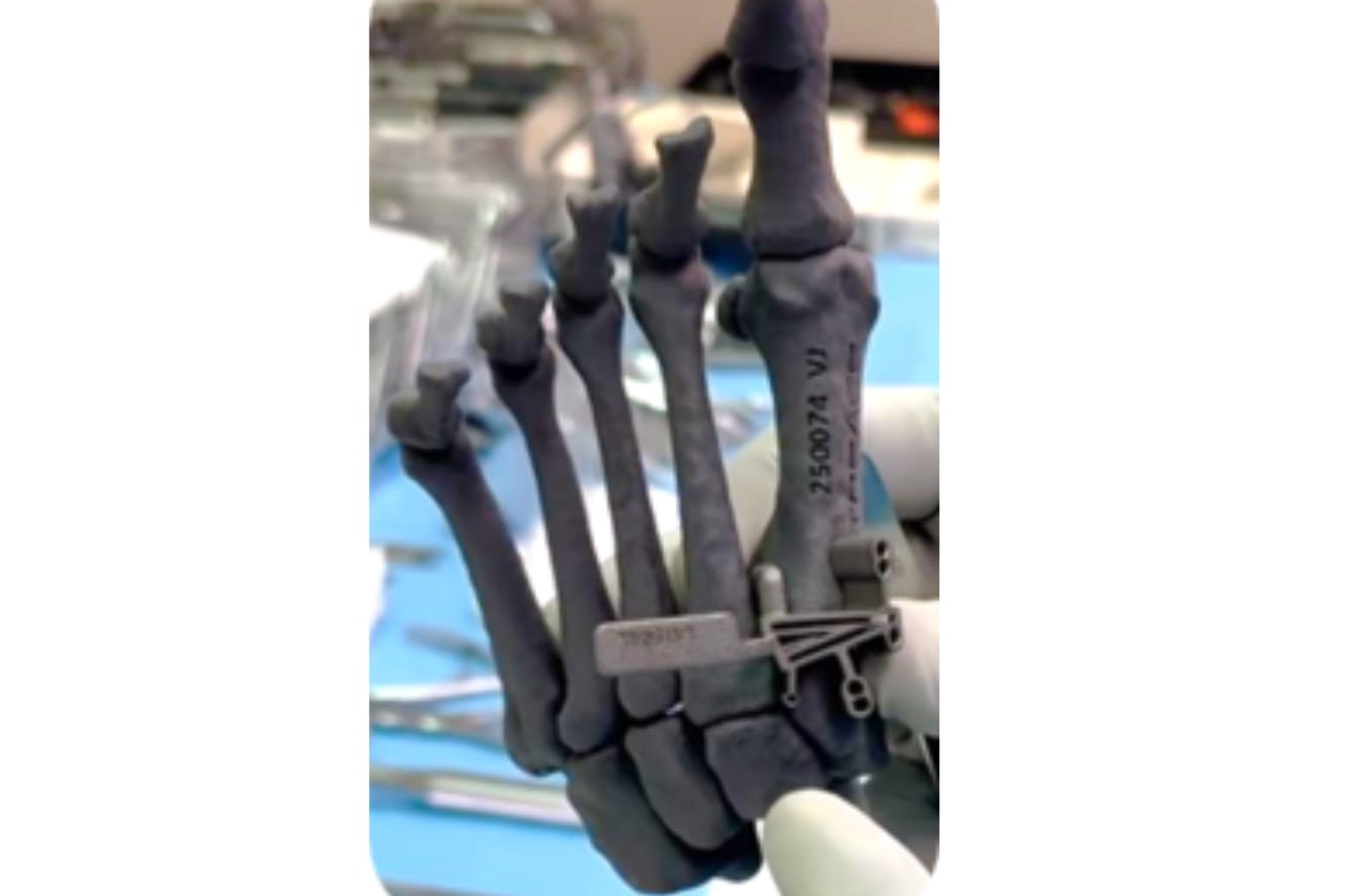 3D printed hand model being held by a gloved hand in a lab setting.