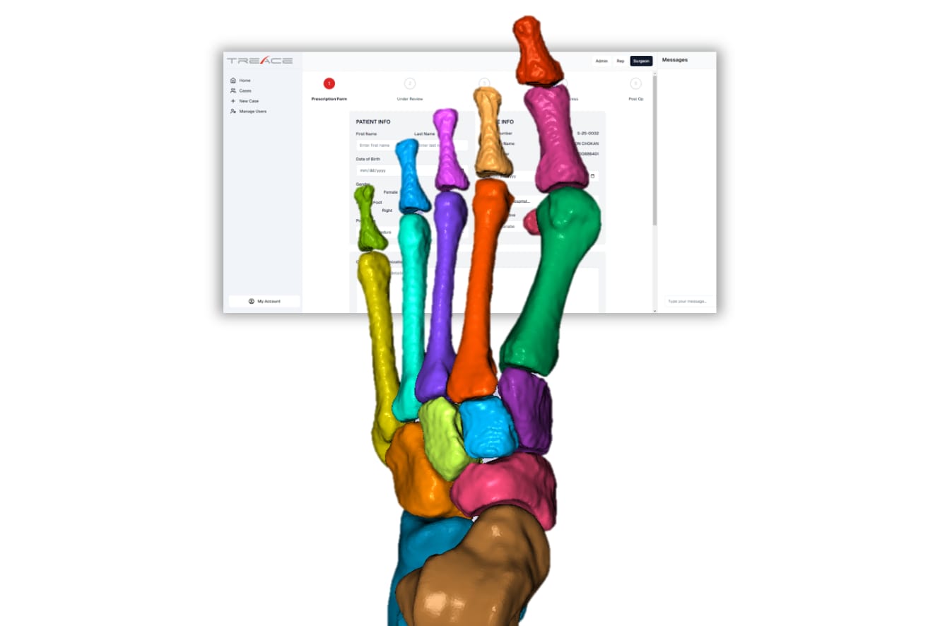 Colored 3D model of a human hand skeleton in front of a blurred computer screen displaying medical information.