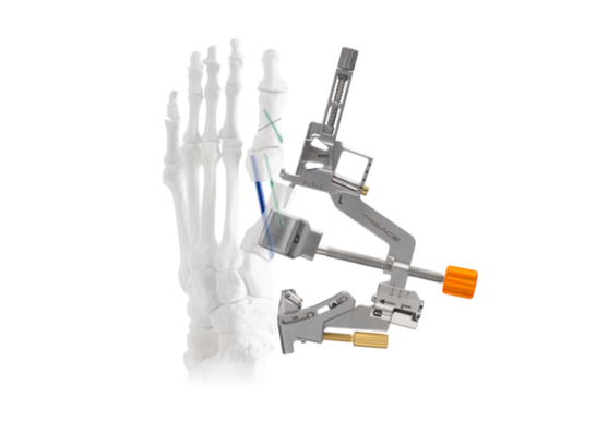 medical tool and screw assembly for foot bone procedure with skeletal foot illustration in background