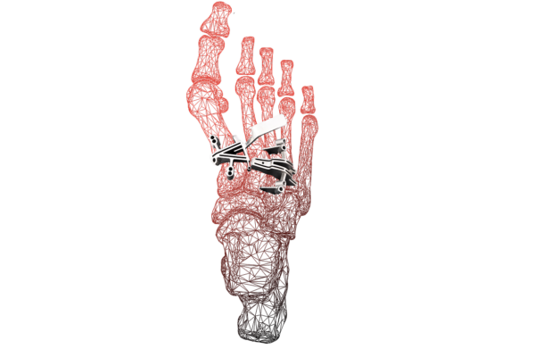 Red skeletal hand holding a stapler against a black background, embodying technology and anatomy.