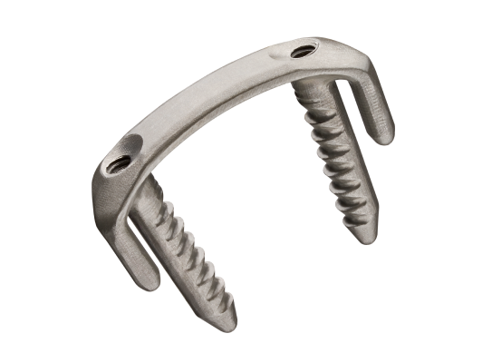 Silver orthopedic spinal implant with two screw-like ends against a white background.