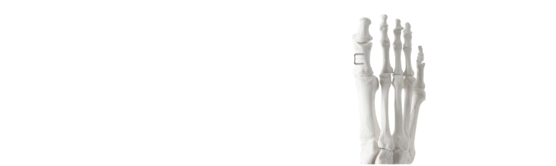 Anatomical model of human foot bones showing structural details against a white background.