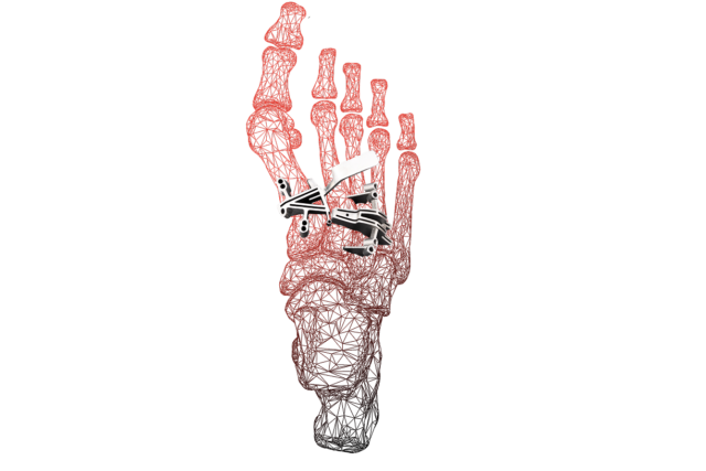 Red skeletal hand holding a small white and black drone against a black background.