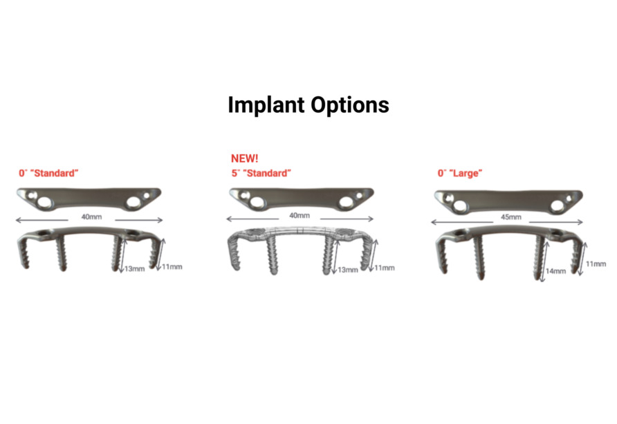 Chart showing implant options with dimensions for Standard and Large sizes, including heights and widths.
