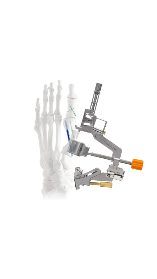 Surgical device aligned with an anatomical model of a human foot skeleton, showcasing precision in medical equipment use.