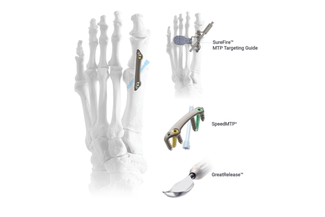 Illustration of a foot skeleton with medical implants such as SureFire MTP Targeting Guide, SpeedMTP, and GreatRelease depicted.