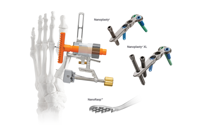 Medical devices for foot and ankle surgery, including screws, plates, and a skeletal illustration, showcasing surgical tools.