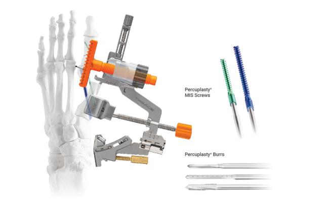 Medical illustration of foot bone with Percuplast MIS Screws and Burrs for surgical procedures.