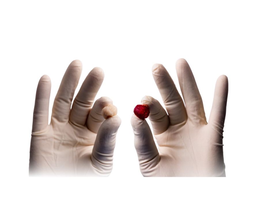 Gloved hands holding two small round objects, one red and one tan, against a black background.