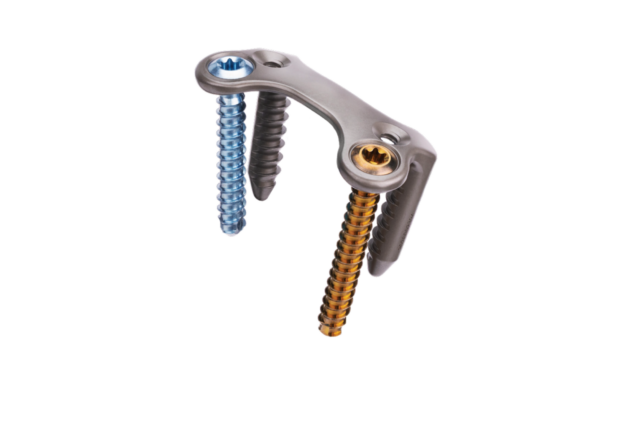 Metal orthopedic implant with three screws attached, used for bone stabilization in surgical procedures.